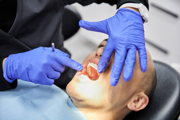 Best Emergency Dentist for Knocked-Out Tooth in Winter Park, FL
