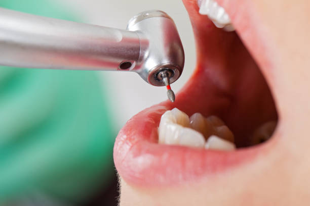 Best Pediatric Emergency Dentist in Winter Park, FL